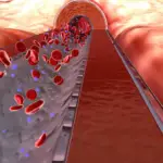 Insulin Therapy for Hyperkalemia Effective-Treatment